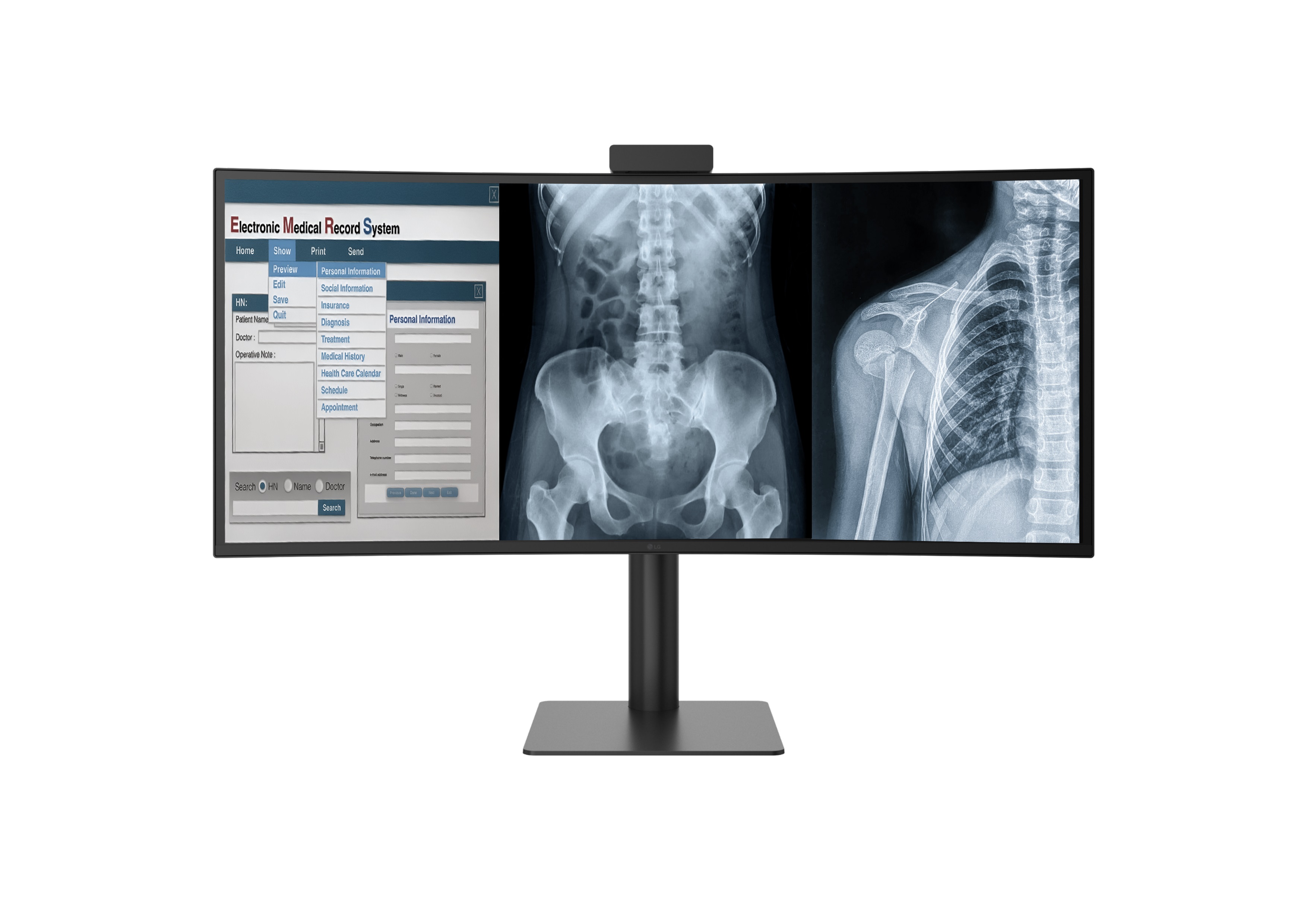 LG presenta nueva tecnología para optimizar los procesos de diagnóstico médico